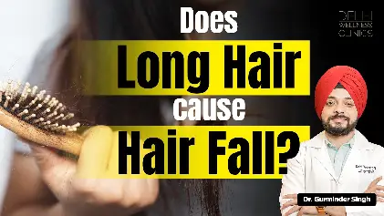 Does long hair cause hair fall? | PCOS and Hair Loss | Delhi Wellness Clinics